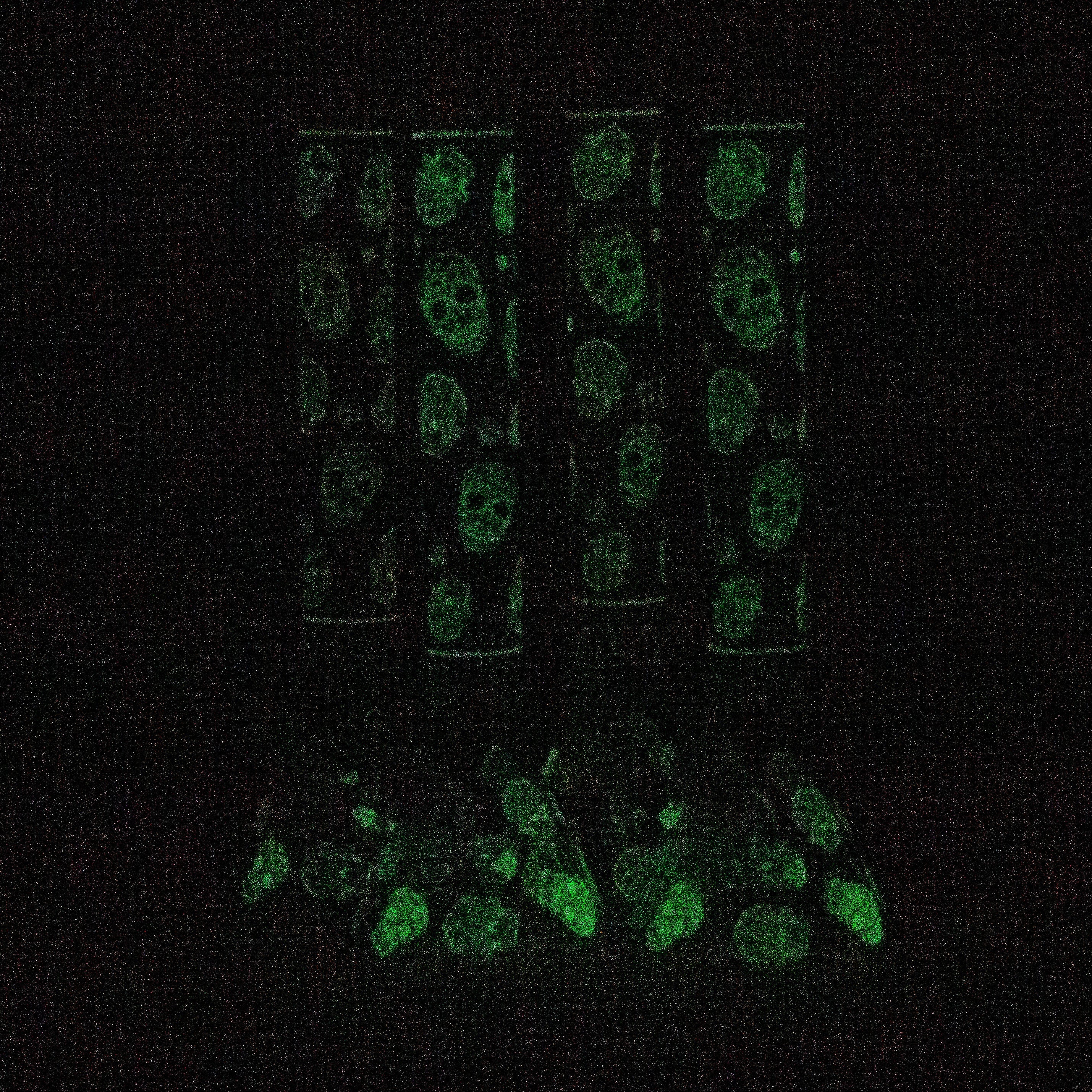 18" Skull Glow in the dark 7 mm glass water bong